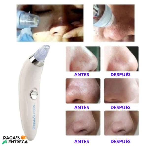 Derma Suction - Extractor de puntos Negros