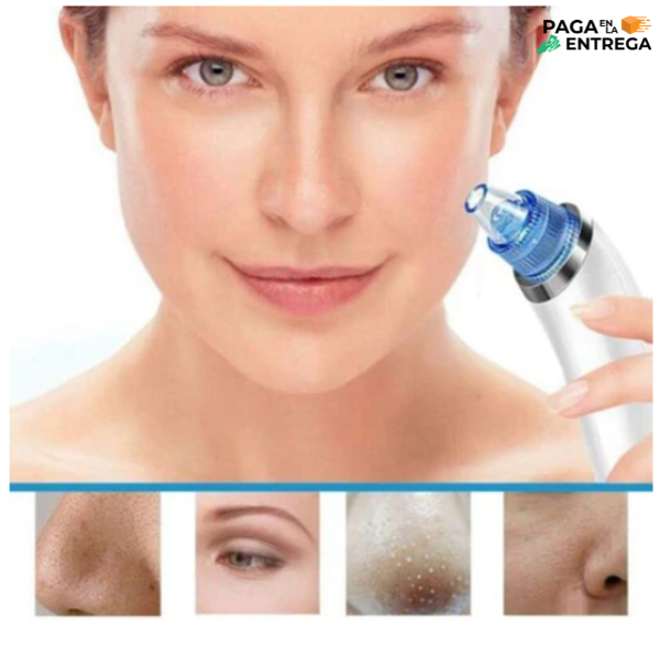 Derma Suction - Extractor de puntos Negros