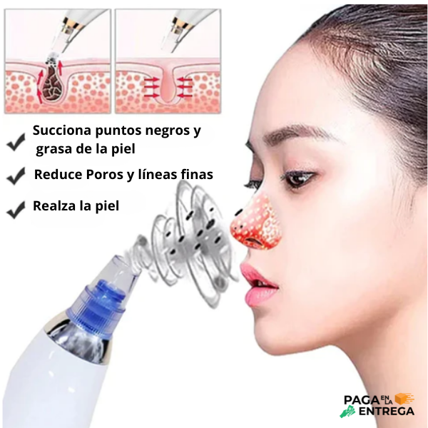 Derma Suction - Extractor de puntos Negros