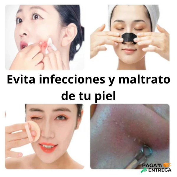 Derma Suction - Extractor de puntos Negros