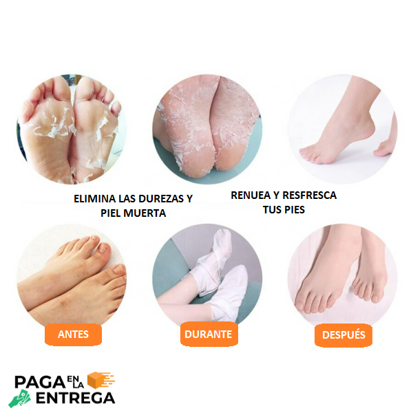 FEETCARE - Mascarilla renovadora de pies 👣