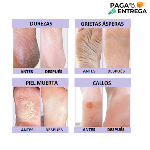 FEETCARE - Mascarilla renovadora de pies 👣