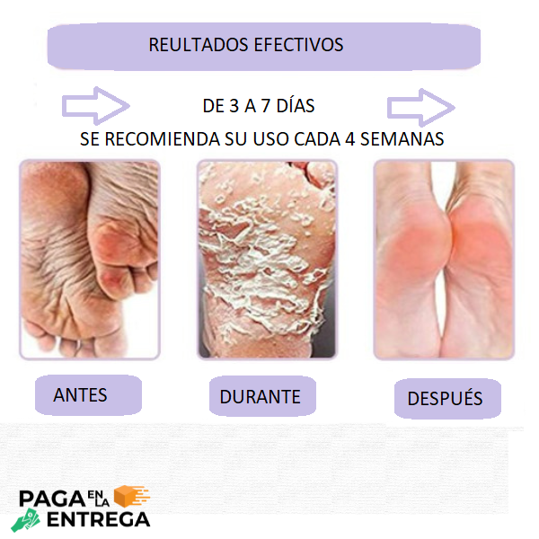 FEETCARE - Mascarilla renovadora de pies 👣